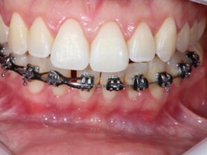 dentistica