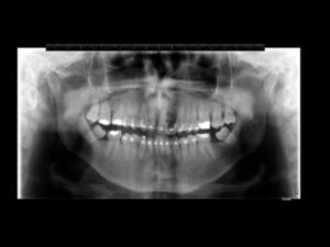 endodontia
